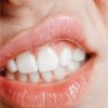 唇に口内炎が出来る原因は？３つの治し方を知っておこう！